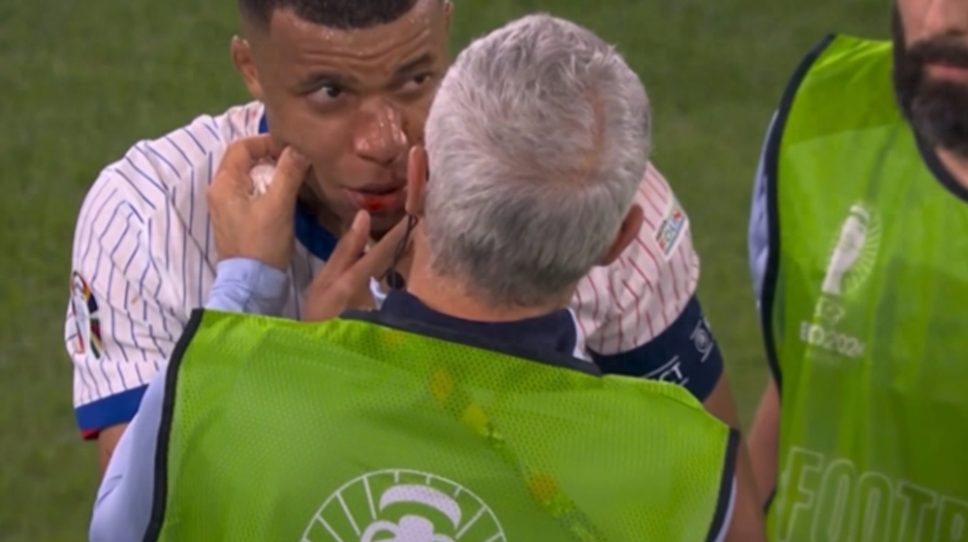 姆巴佩将戴面具出场？这个面具照刷屏