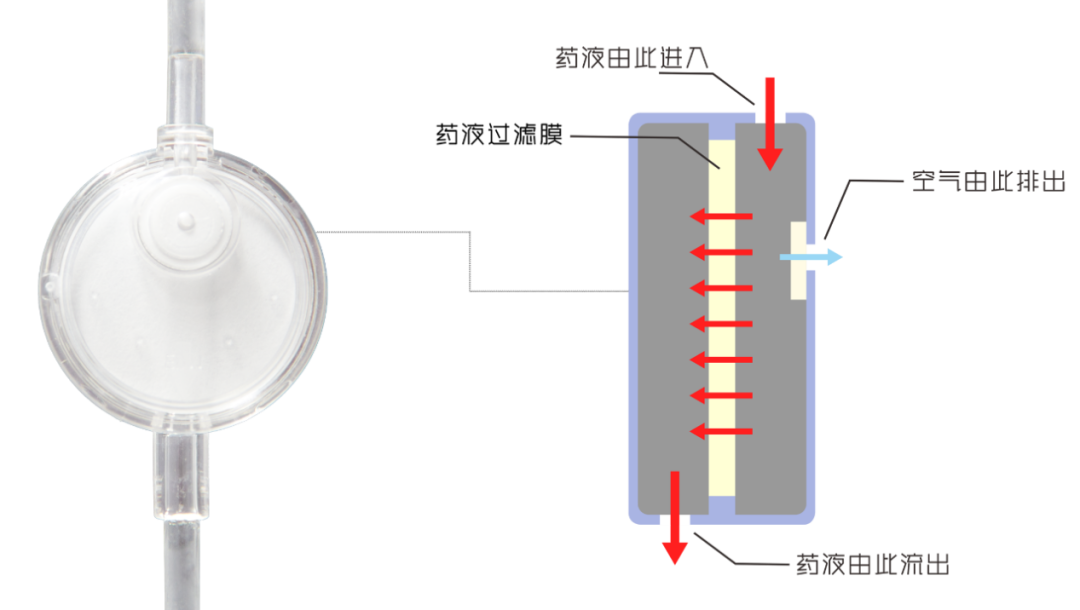 什么是精密输液器科普 ｜ “五花八门”输液器_https://www.jmylbn.com_新闻资讯_第10张