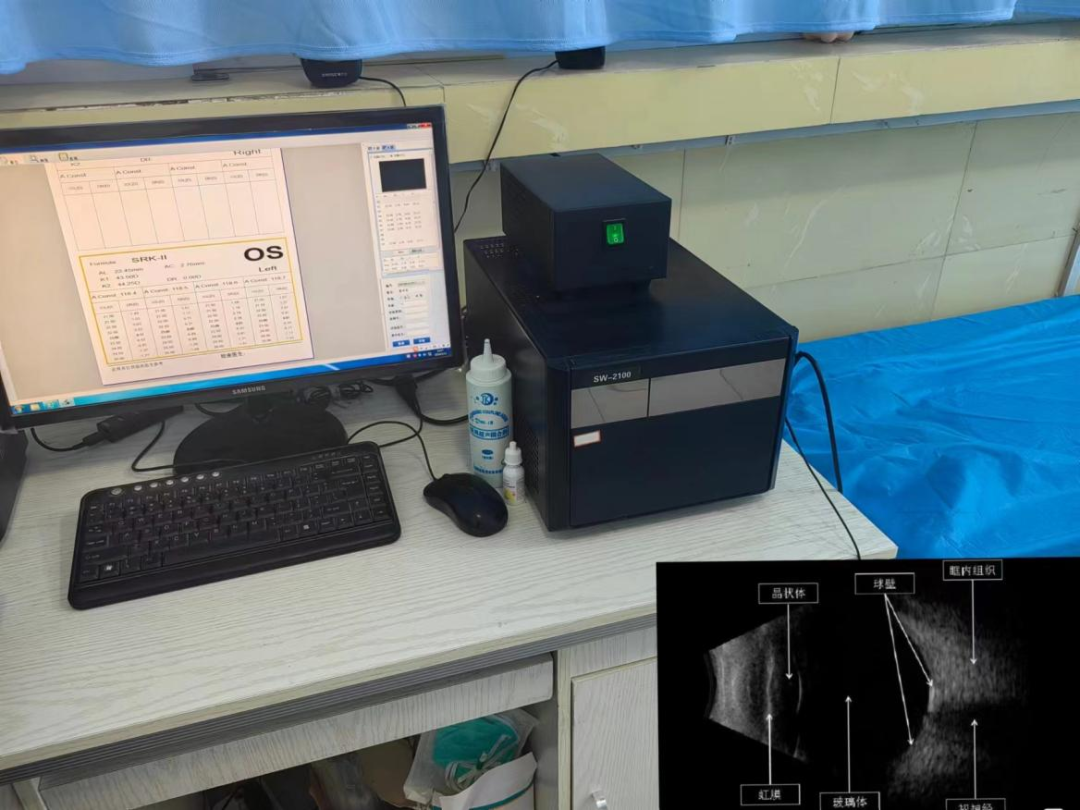 眼科检查仪器叫什么【科普时间】眼科仪器知多少？_https://www.jmylbn.com_新闻资讯_第4张