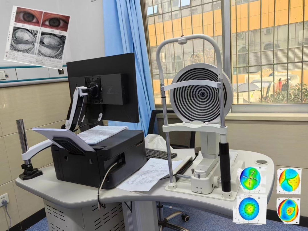 眼科检查仪器叫什么【科普时间】眼科仪器知多少？_https://www.jmylbn.com_新闻资讯_第8张