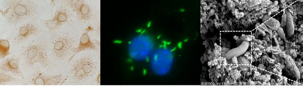 胞内劳森菌临床强毒菌株的分离鉴定