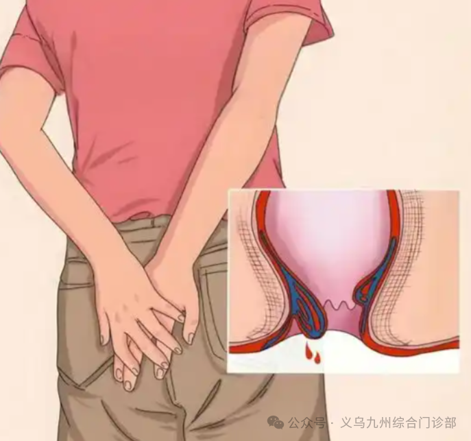 肛肠手术后多久能开车？术后恢复期这些事不能做