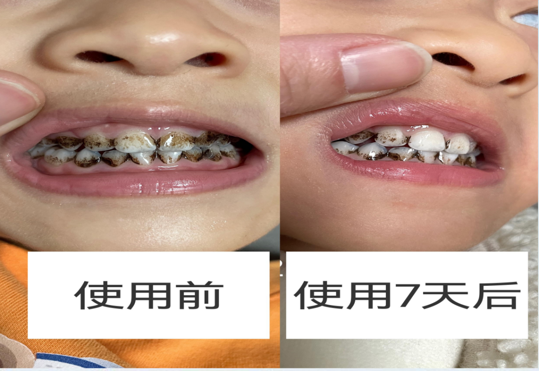 治疗床怎么用看着在治疗床上哇哇哭的孩子，“再也不敢了，这一件我还是老老实实给孩子买贵的…”_https://www.jmylbn.com_新闻资讯_第45张