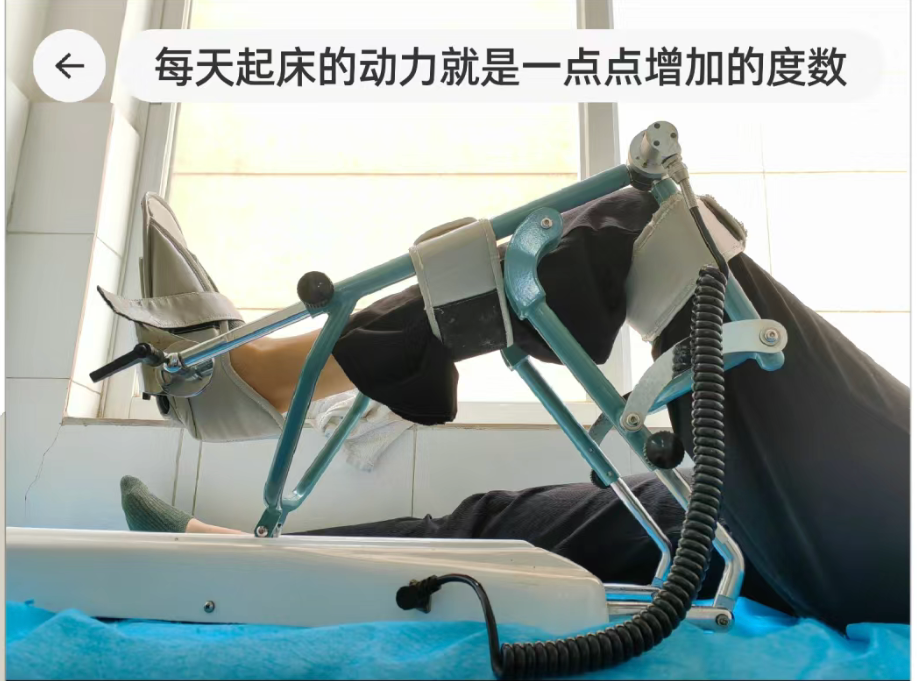 康复综合治疗仪怎么样骨科康复神器—CPM治疗仪_https://www.jmylbn.com_新闻资讯_第2张