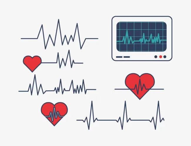 心电图仪器怎么连接【功能检查】四大常规仪器检查之——带您了解心电图_https://www.jmylbn.com_新闻资讯_第12张