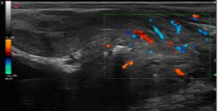 百胜彩超怎么样【州医先进设备】精准诊断引领精准治疗（十）——介入超声新利器，百胜MyLab 9引领精准医疗_https://www.jmylbn.com_新闻资讯_第9张
