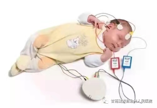 听性脑干反应检查是什么【能力提升】甘南州人民医院耳鼻喉科成功开展耳声发射、听性脑干反应（ABR）检查_https://www.jmylbn.com_新闻资讯_第7张
