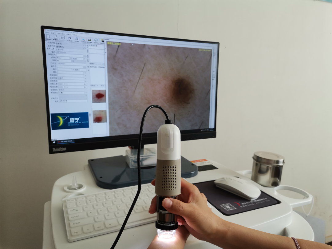 医用皮肤镜什么牌子好皮肤科医生的“第三只眼” ：神奇的“皮肤镜”！_https://www.jmylbn.com_新闻资讯_第5张