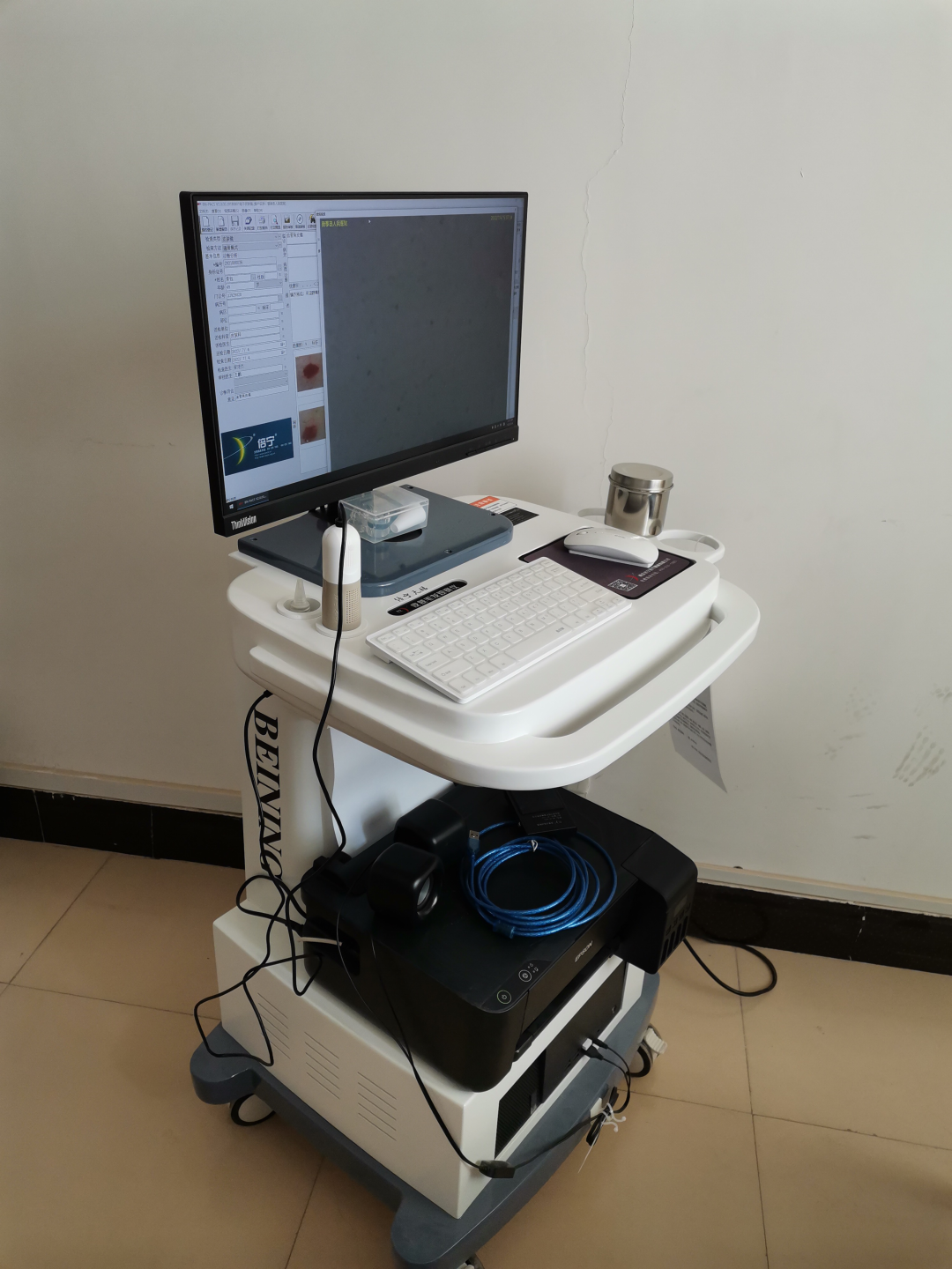 医用皮肤镜什么牌子好皮肤科医生的“第三只眼” ：神奇的“皮肤镜”！_https://www.jmylbn.com_新闻资讯_第4张