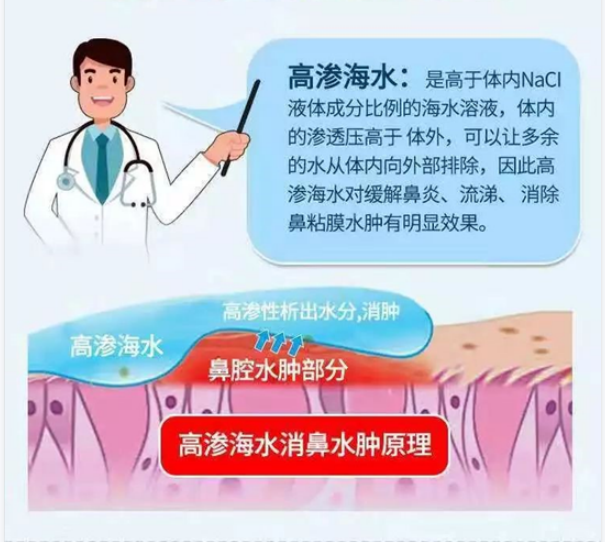 医用雾化机器怎么清洗阳了，怎么通过鼻腔冲洗缓解症状？_https://www.jmylbn.com_新闻资讯_第8张