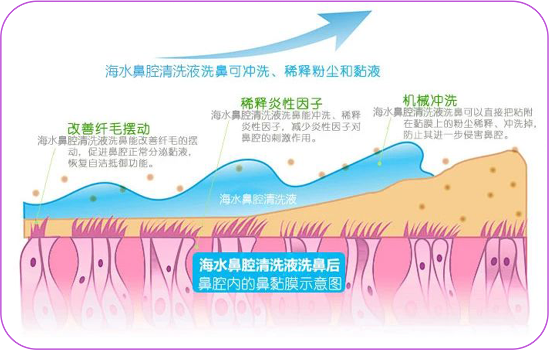 医用雾化机器怎么清洗阳了，怎么通过鼻腔冲洗缓解症状？_https://www.jmylbn.com_新闻资讯_第2张