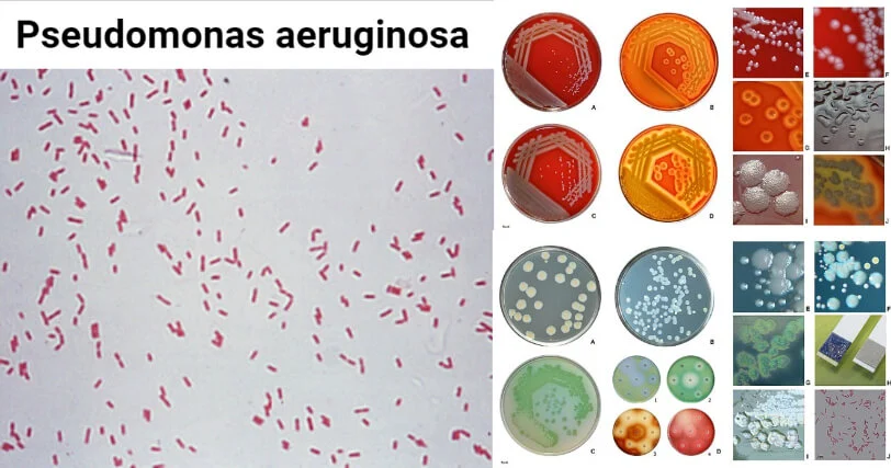 从高分子物理到合成生物学的金帆研究员：生命科学急需抽象的数学定理的图4