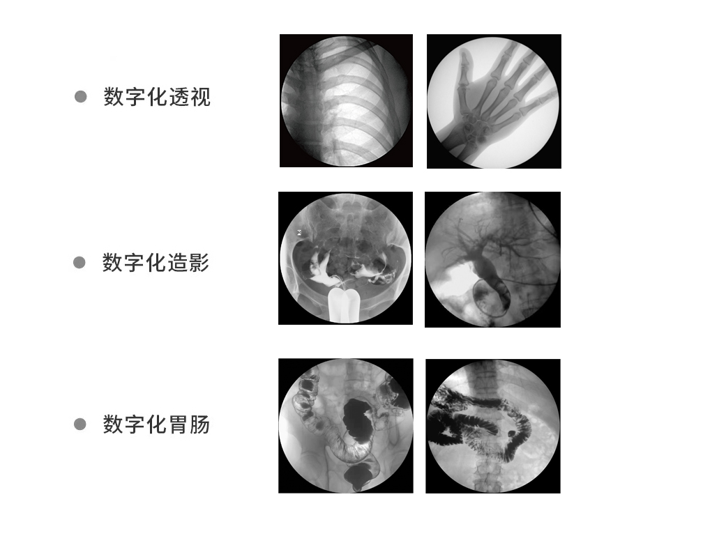 DR机怎么曝光【专科建设】高品质动态影像专家——梅河口市中医院引进多功能数字动态平板DRF（数字胃肠DR一体机）_https://www.jmylbn.com_新闻资讯_第8张