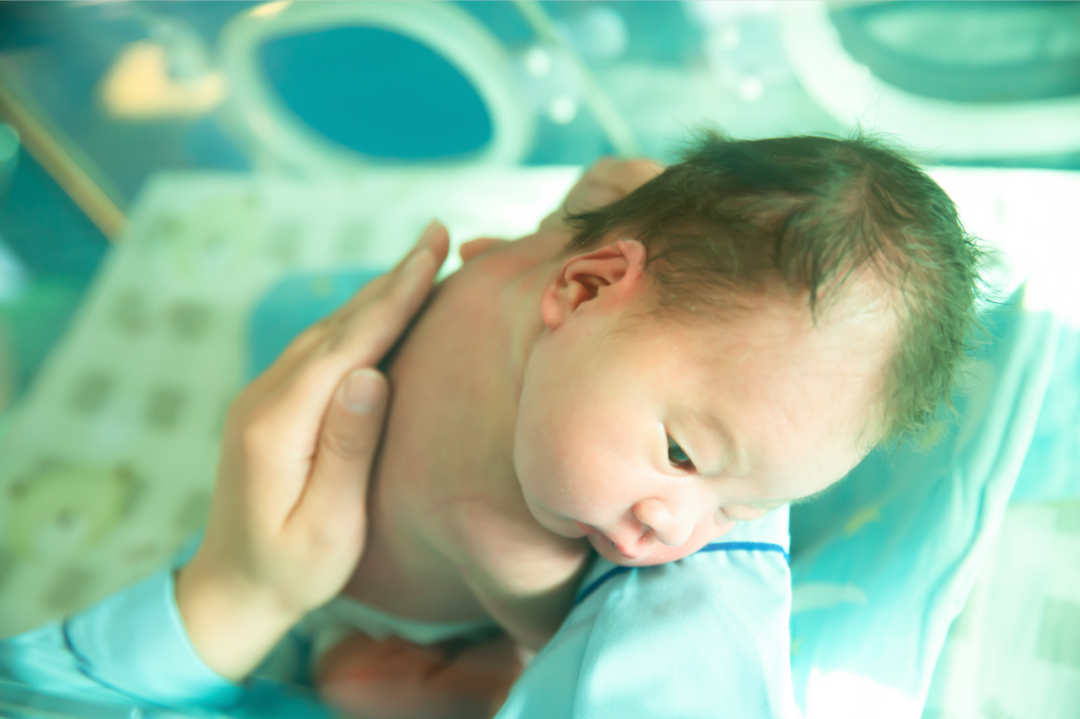 为什么要用光疗纸尿裤新生儿黄疸不用住院！卧龙区妇幼保健院日间光疗，宝宝白天做光疗，晚上回怀抱_https://www.jmylbn.com_新闻资讯_第5张