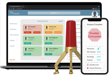 闭环神经调控：非侵入式脑机接口的进阶逻辑 | 倚锋硬分享