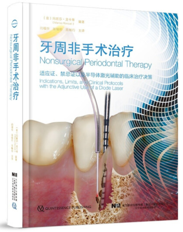 口腔激光怎么治疗“难治性”牙周炎的激光辅助治疗_https://www.jmylbn.com_新闻资讯_第18张