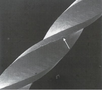 根管马达怎么修根管内器械分离的影响因素_https://www.jmylbn.com_新闻资讯_第6张