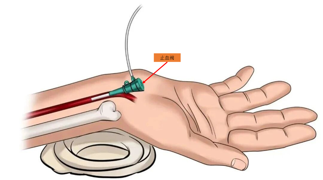 导管鞘怎么念导管鞘的介绍_https://www.jmylbn.com_新闻资讯_第4张