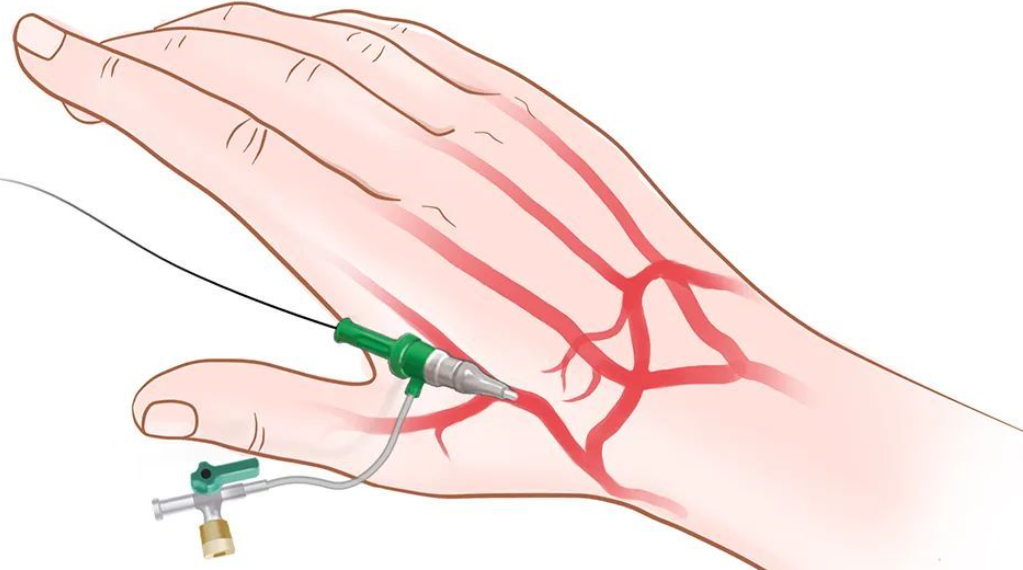 导管鞘怎么念导管鞘的介绍_https://www.jmylbn.com_新闻资讯_第5张