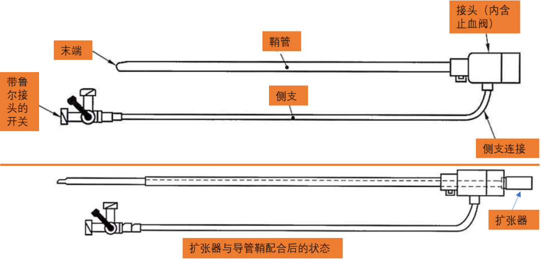 导管鞘怎么念导管鞘的介绍_https://www.jmylbn.com_新闻资讯_第2张