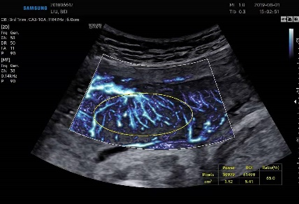 三星彩超怎么样【便民服务】四维彩超界“新王者”——三星HERA女神超声仪，给孕妈妈们一份安心！_https://www.jmylbn.com_新闻资讯_第15张