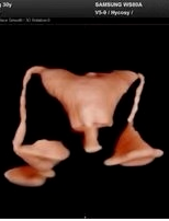 三星彩超怎么样【便民服务】四维彩超界“新王者”——三星HERA女神超声仪，给孕妈妈们一份安心！_https://www.jmylbn.com_新闻资讯_第22张