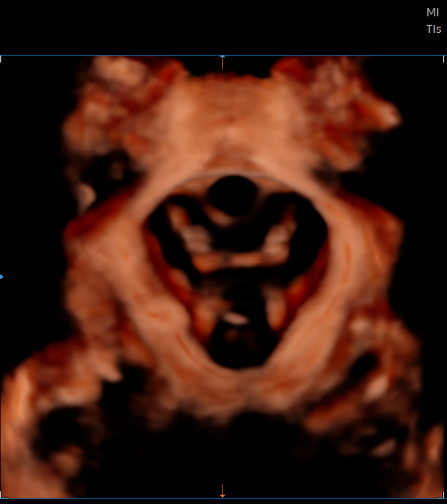 三星彩超怎么样【便民服务】四维彩超界“新王者”——三星HERA女神超声仪，给孕妈妈们一份安心！_https://www.jmylbn.com_新闻资讯_第21张