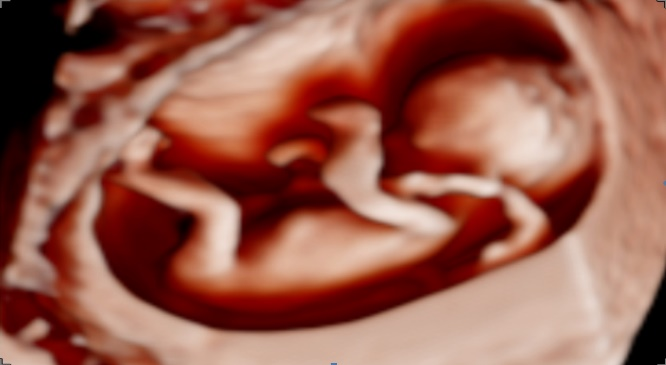 三星彩超怎么样【便民服务】四维彩超界“新王者”——三星HERA女神超声仪，给孕妈妈们一份安心！_https://www.jmylbn.com_新闻资讯_第8张