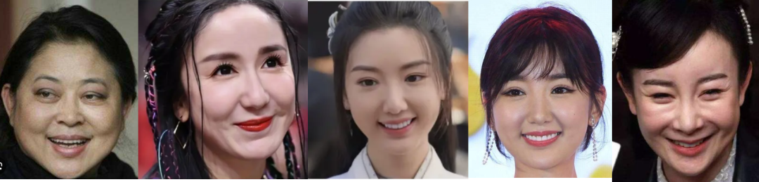 女子过度医美面部馒化酷似面具人,医美后遗症——比变老更可怕的“面部馒化”