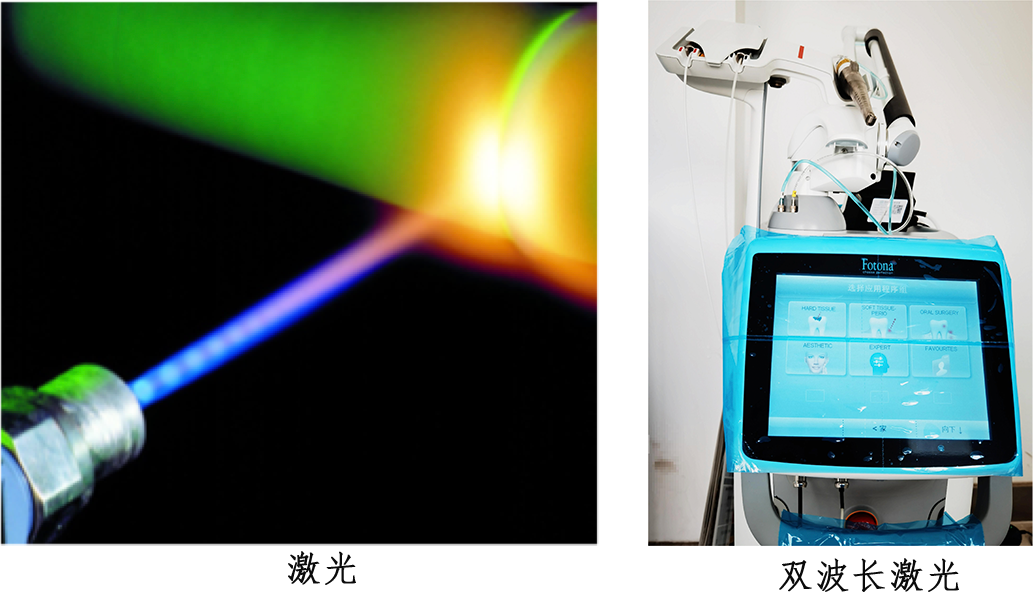 口腔激光怎么治疗口腔特色诊疗——激光治疗_https://www.jmylbn.com_新闻资讯_第1张