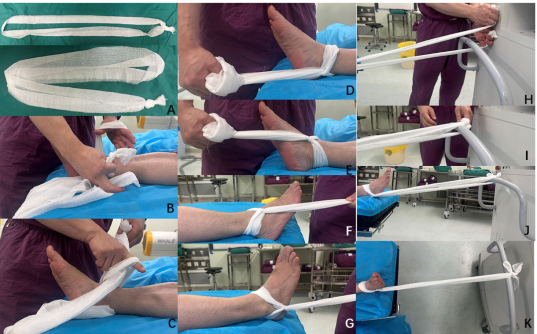 在没有牵引床的情况下，一种简单的牵引方法髓内钉固定粗隆间骨折
