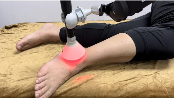 偏振光治疗仪怎么用【有医说医】无创无痛、无副作用！康复科偏振光治疗为您解除病痛_https://www.jmylbn.com_新闻资讯_第4张