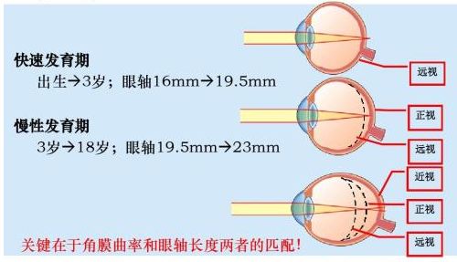 青少年视力健康档案随学籍转移