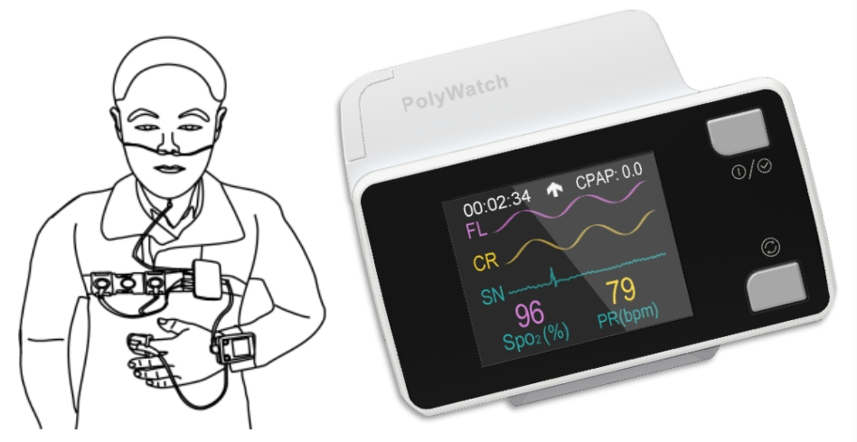 压力滴定怎么做【睡眠科普】太忙没时间做多导睡眠监测（PSG)，这个神器助您在家操作!_https://www.jmylbn.com_新闻资讯_第2张