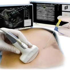 介入引流管怎么关【健康科普】超声介入活检（置管）术后注意事项_https://www.jmylbn.com_新闻资讯_第1张