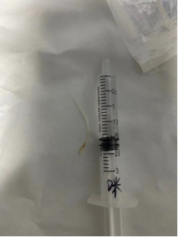 什么牌子的气管好孩子肺炎老不好，医生让做的气管镜到底是什么？_https://www.jmylbn.com_新闻资讯_第15张