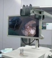 什么牌子的气管好孩子肺炎老不好，医生让做的气管镜到底是什么？_https://www.jmylbn.com_新闻资讯_第13张