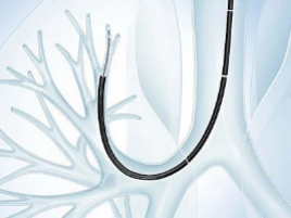 什么牌子的气管好孩子肺炎老不好，医生让做的气管镜到底是什么？_https://www.jmylbn.com_新闻资讯_第2张