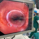 什么牌子的气管好孩子肺炎老不好，医生让做的气管镜到底是什么？_https://www.jmylbn.com_新闻资讯_第26张