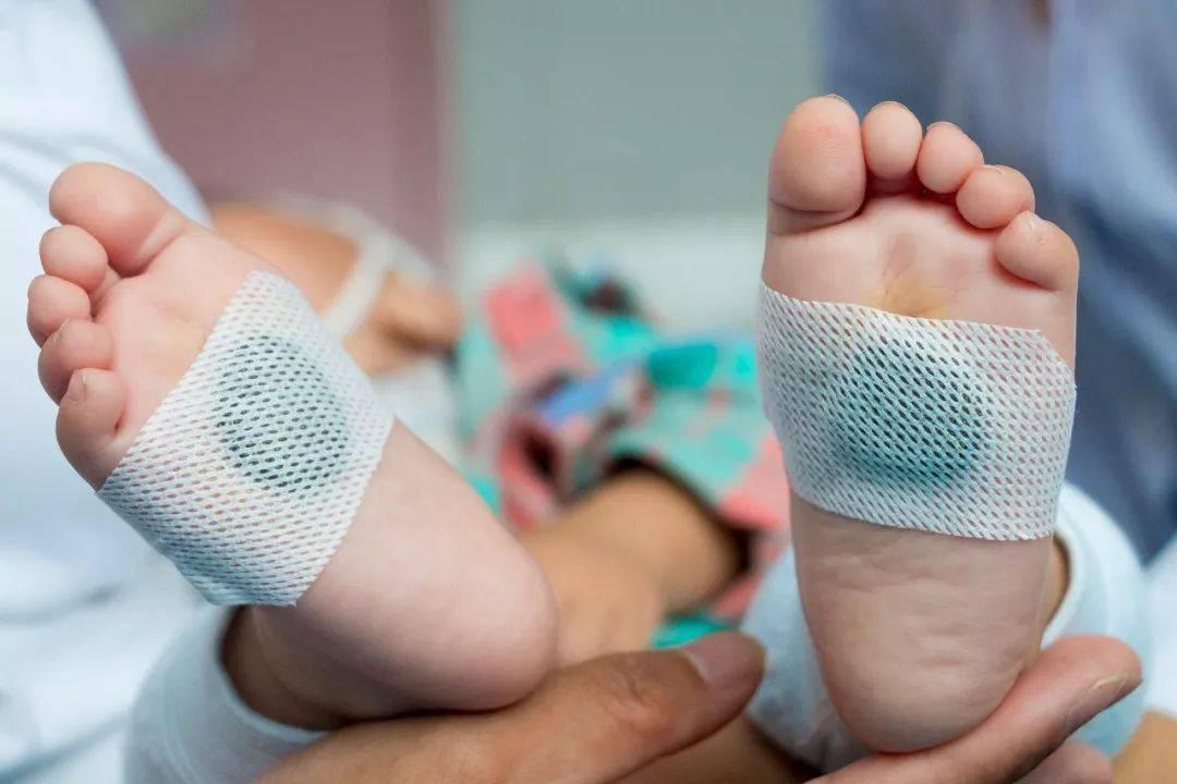 中医外治方法—穴位贴敷法