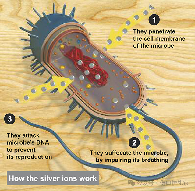 为什么用银敷含银敷料（Silver Dressing）_https://www.jmylbn.com_新闻资讯_第12张