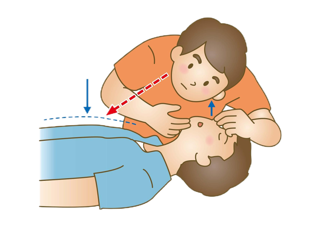 cpr按压板怎么放置【健康之窗】急救科普 ｜ 心肺复苏（CPR）全攻略_https://www.jmylbn.com_新闻资讯_第39张