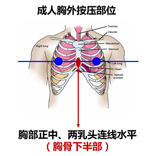 cpr按压板怎么放置【健康之窗】急救科普 ｜ 心肺复苏（CPR）全攻略_https://www.jmylbn.com_新闻资讯_第26张