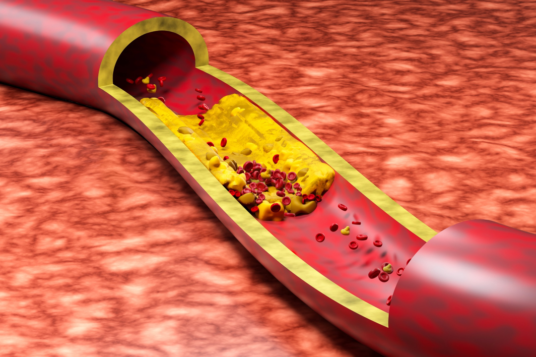 什么是臭氧大自血疗法三氧大自血疗法——20岁～42岁是血脂快速上升期，预防大于治疗_https://www.jmylbn.com_新闻资讯_第2张