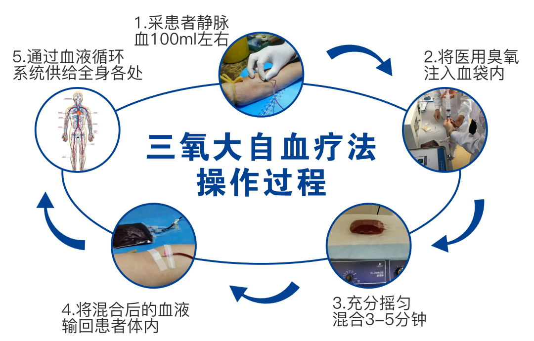 什么是臭氧大自血疗法三氧大自血疗法——20岁～42岁是血脂快速上升期，预防大于治疗_https://www.jmylbn.com_新闻资讯_第3张