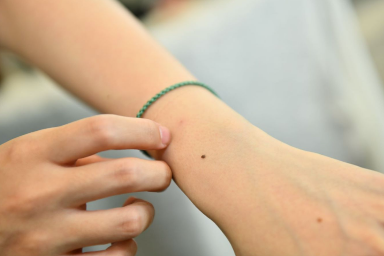 免疫力差的表现，哪些药可以提高免疫力