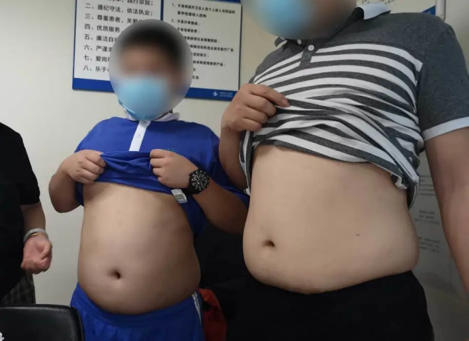 11歲男孩重度肝硬化，醫生檢查完發現：一個常見的飲食習慣害了他！ 健康 第2張
