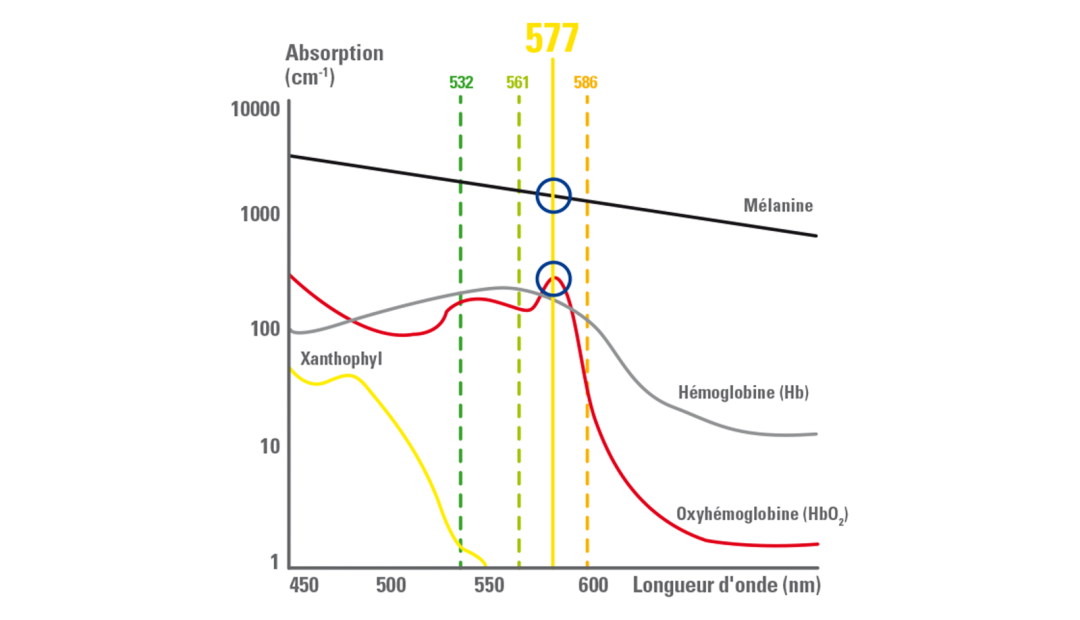 眼底激光机有什么牌子眼底病患者的福音—热烈祝贺楚雄州首台“法国光太新一代577nm光纤激光眼底治疗仪”入驻楚雄复明眼科医院_https://www.jmylbn.com_新闻资讯_第4张