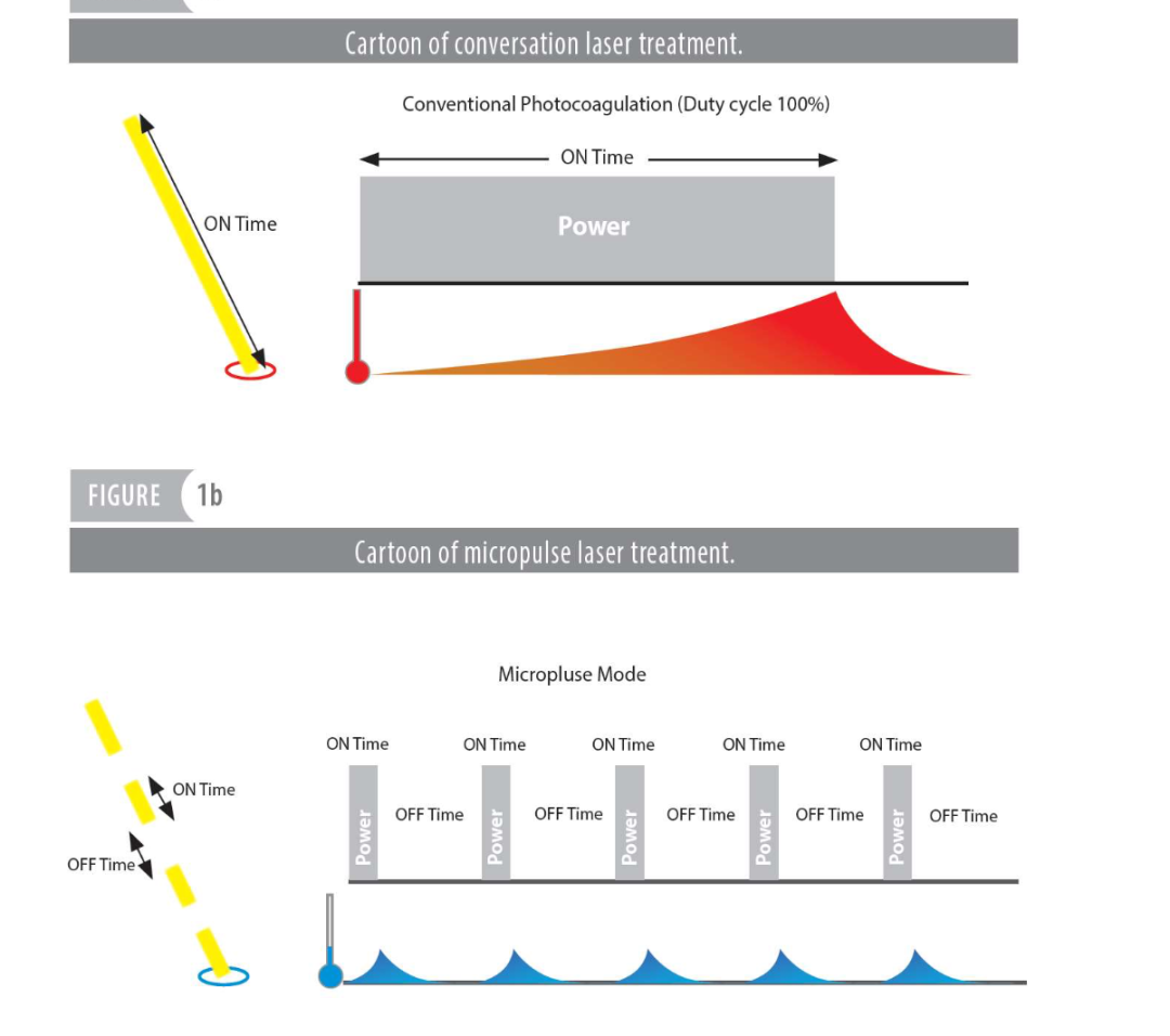眼底激光机有什么牌子眼底病患者的福音—热烈祝贺楚雄州首台“法国光太新一代577nm光纤激光眼底治疗仪”入驻楚雄复明眼科医院_https://www.jmylbn.com_新闻资讯_第6张