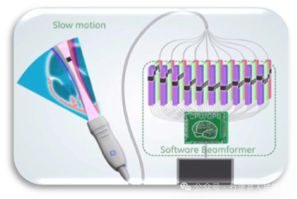 logiq e怎么读【高端设备】从多个维度观察血管、组织的血流灌注、像素合成在瞬间完成——美国GE超声高端旗舰机LOGIQ™ E11_https://www.jmylbn.com_新闻资讯_第7张